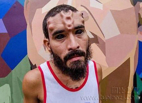 Ƥֲɫûй񫣬һDamonһλҽѧԺѧEmilio Gonzalezרͼ죬DamonҪס