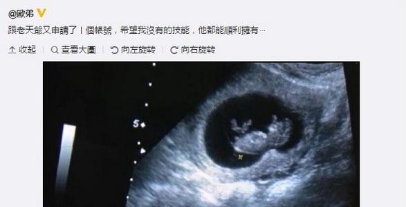 欧弟晒出怀孕妻子B超图